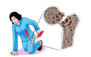 Homepage_articles_thumb_osteoporosis-1